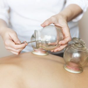 Fire Cupping treatment